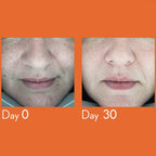 Dark Spot Remover Serum 30ml